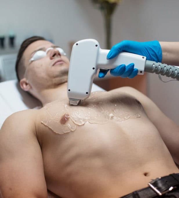 Diódalézeres szőrtelenítés férfiaknak – Miért válaszd és hogyan működik?